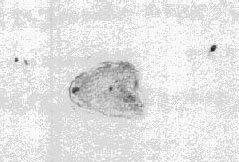 NGC 6804
